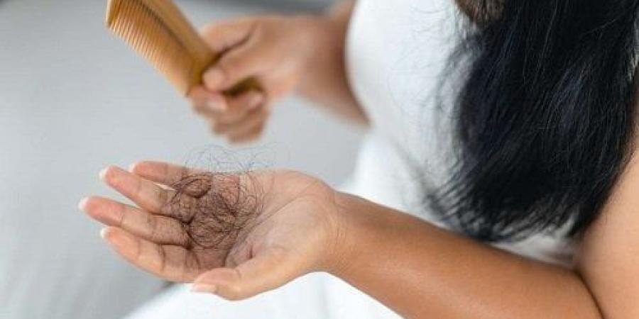 أفضل 10 شامبو ضد تساقط الشعر طبي وأكثر مبيعاً في لبنان 2025