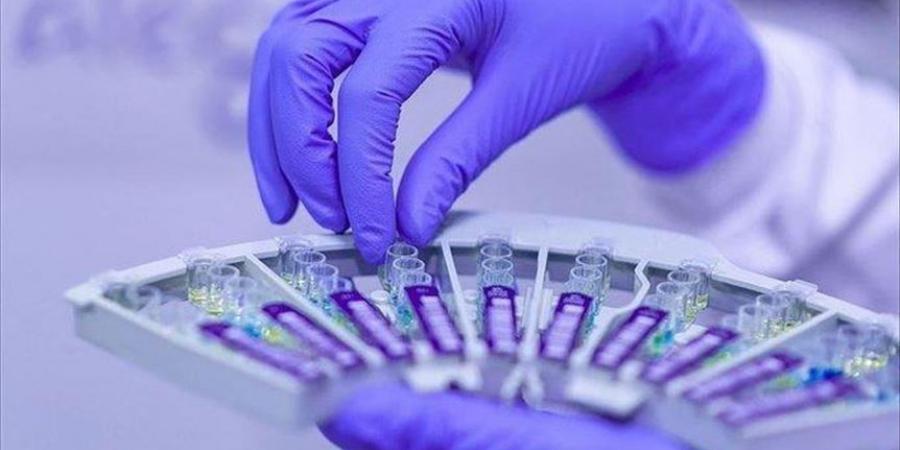 خبير:انتقال فيروسات الميربيكو إلى البشر مسألة وقت