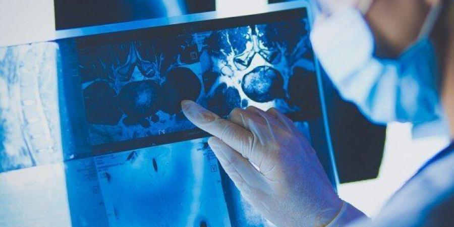 طريقة واعدة لاكتشاف السرطان قبل ظهور الأعراض بثلاثة أعوام