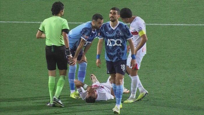 طبيب الزمالك يكشف تفاصيل إصابة ثلاثي الفريق خلال مواجهة بيراميدز