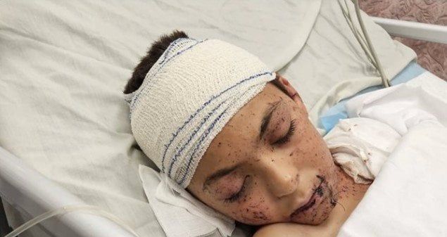إيطاليا ستستقبل طفلًا فلسطينيًا نجا من القصف الإسرائيلي الأسبوع المقبل