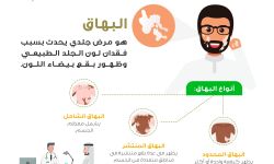 ما هو البهاق وما أنواعه ؟