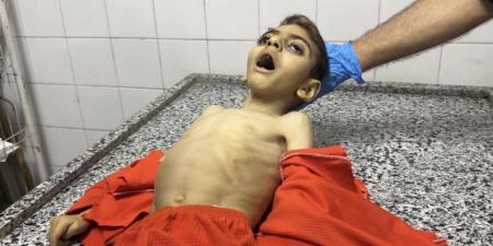 استشهاد طفل جوعا في غزة