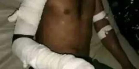 جريمة مروعة .. عامل يحاول حرق أصدقائه أحياء بمحافظة الضالع -صور