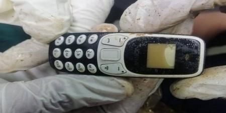 في واقعة نادرة.. استخراج هاتف محمول من بطن شاب بعد عامين من ابتلاعه