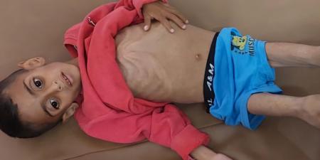 غزة | قصف متواصل… واستشهاد 66 طفلاً حتى الآن نتيجة سوء التغذية