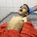استشهاد طفل جوعا في غزة