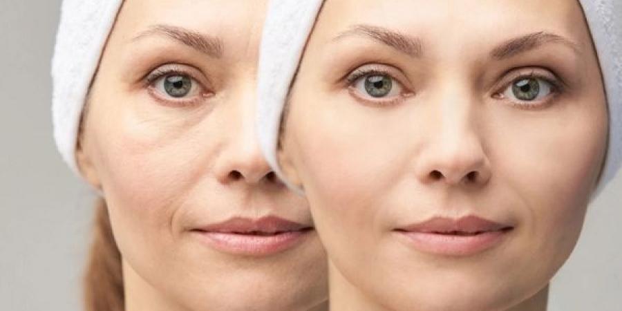 7 أسباب تؤدي إلى انتفاخ الوجه