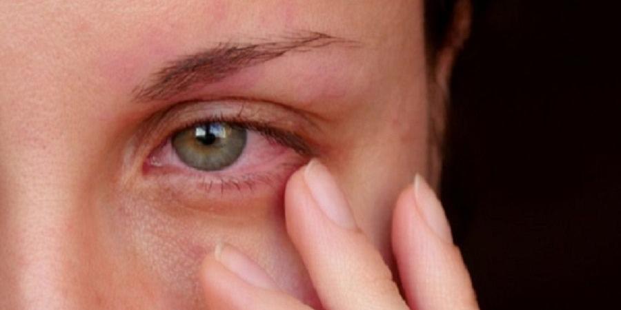 5 مشكلات عيون شائعة تهدد المرأة بعد سن الأربعين