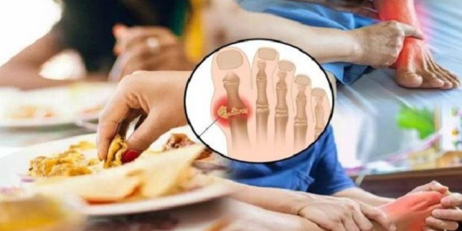 حمض اليوريك .. أطعمة ومشروبات تزيد من مخاطره
