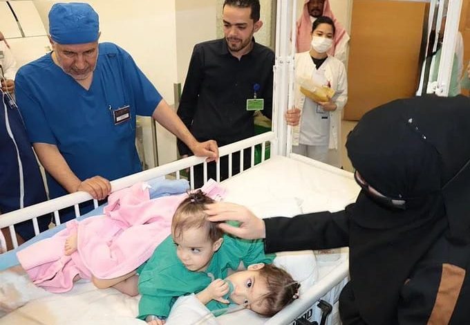 بدء عملية فصل التوأم السيامي السوري "سيلين وإيلين"