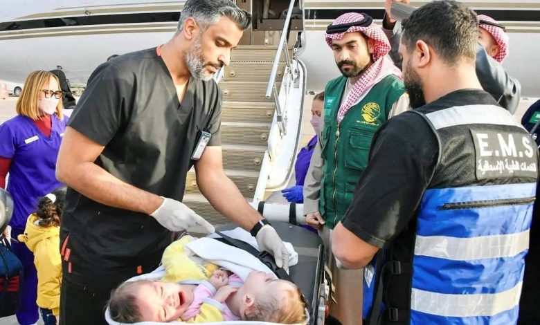 تمت بنجاح.. انتهاء ثاني مراحل فصل التوأم الملتصق السوري سيلين وإيلين في السعودية